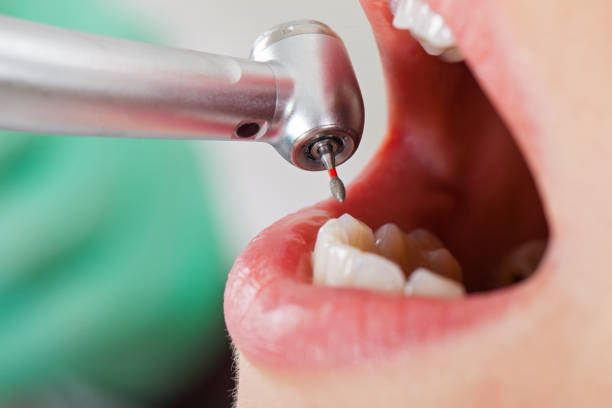 Best Emergency Pediatric Dental Care in Mount Carmel, IL
